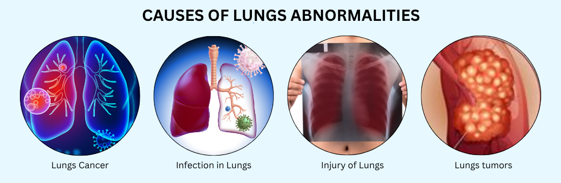 Causes of the Lungs Abnormalities